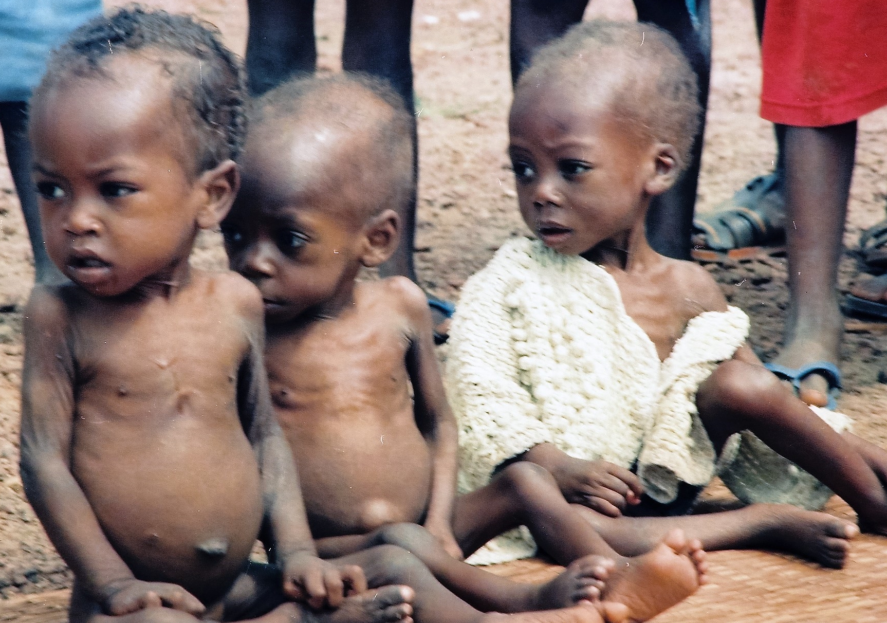 Staving children during the war. Woewiyu as NPFL spokesman says it never happened. Photo: James K. Fasuekoi/The AfricaPaper
