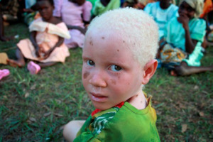 A child with white hair sitting in the grass.